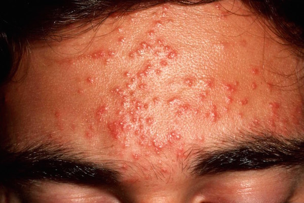 همه چیز درباره استروئیدهای آنابولیک