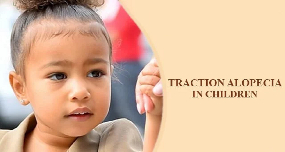 هر آنچه باید درباره علل ریزش مو در کودکان و راه درمان آن ها بدانید