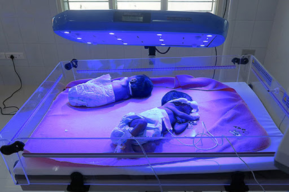 نشانه‌های زردی یا یرقان نوزادان و روشهای درمان آن