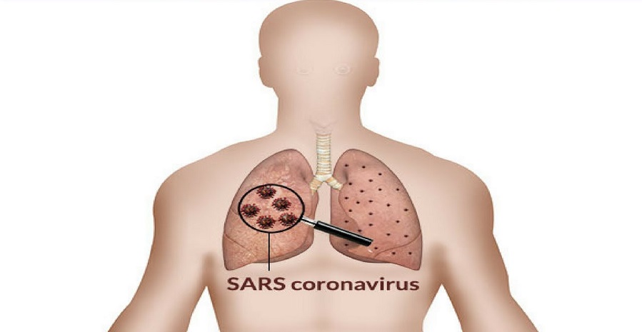 از طاعون سیاه تا کرونا/ نگاهی به تاریخچه بیماری‌های همه گیر در ایران و جهان