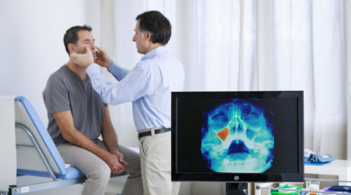 علائم و نشانه‌های سینوزیت مزمن و حاد و علل، تشخیص، درمان و پیشگیری از آن