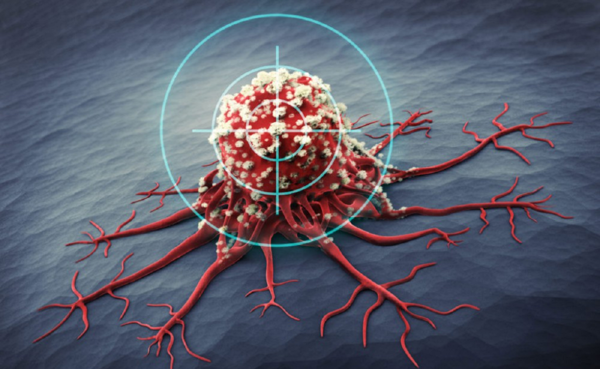 آشنایی با روش های نوین درمان سرطان سینه