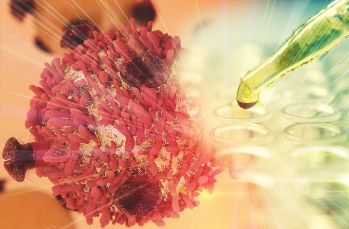 آشنایی با روش های نوین درمان سرطان سینه