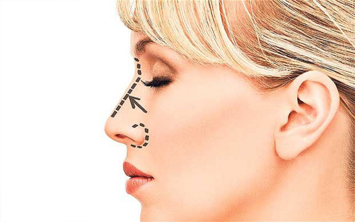 خطرات و عوارض عمل جراحی زیبایی بینی