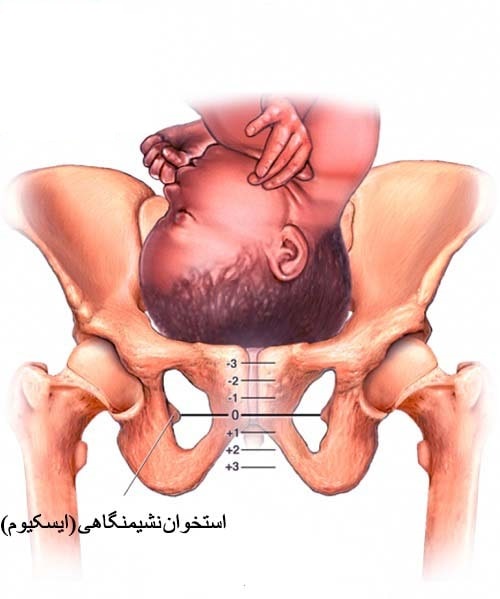همه چیز درباره درد لگن در بارداری