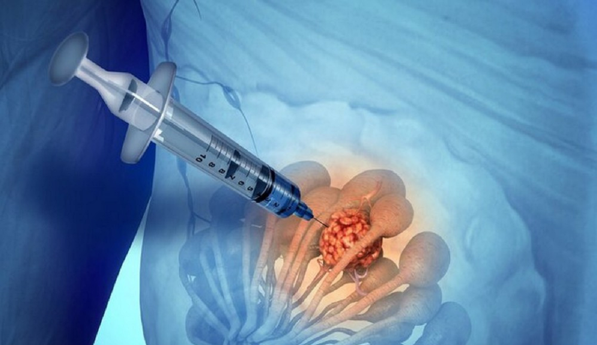 هر آنچه باید در مورد سرطان سینه برانیم