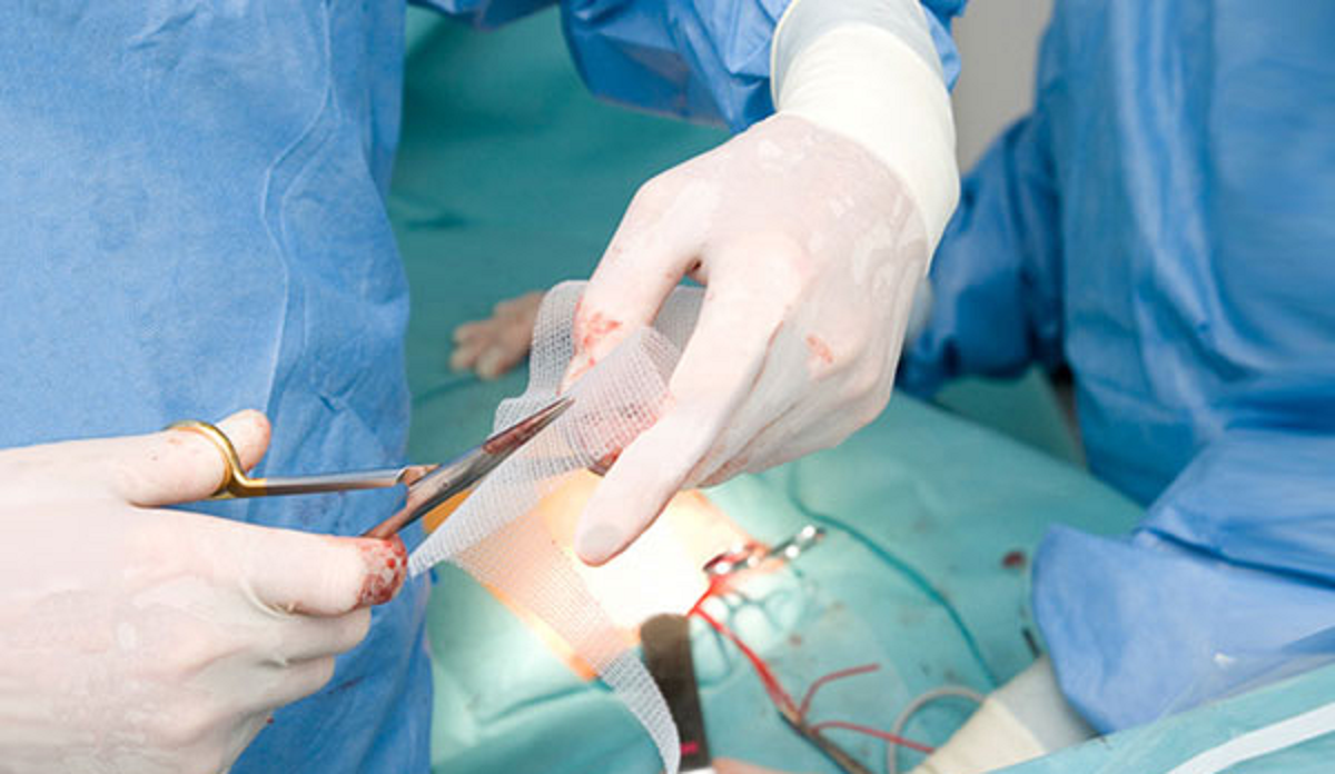 فتق یا باد فتق چیست و  علل، انواع و راه‌های درمان باد فتق