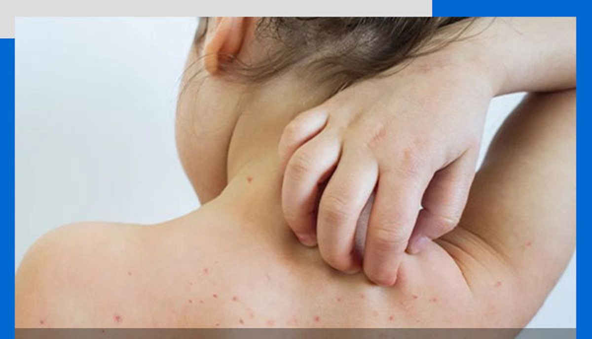 همه چیز درباره واکسن MMR و آنچه والدین باید درباره عوارض احتمالی آن بدانند