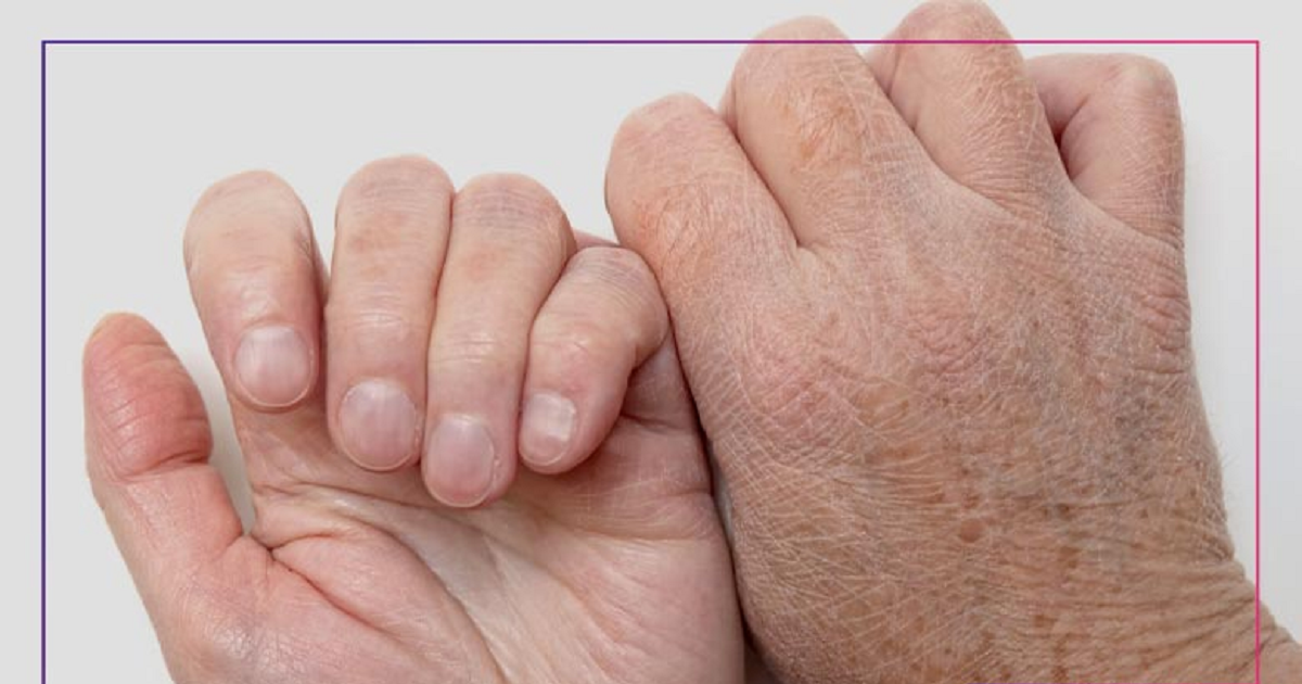 روش‌های معجزه آسا درمان ترک دست و پا