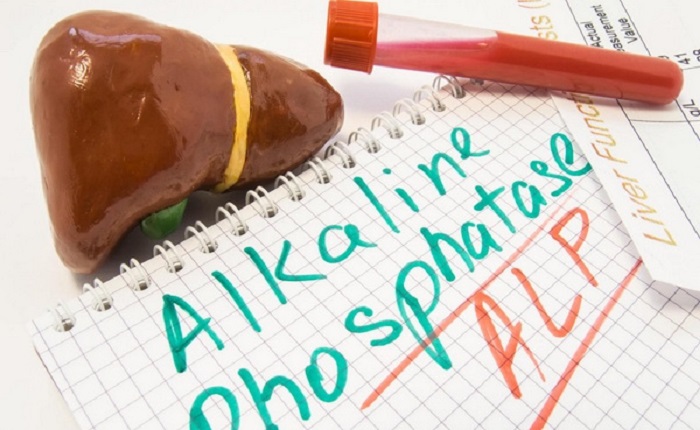 آزمایش عملکرد کبد چیست و چرا انجام میشود؟