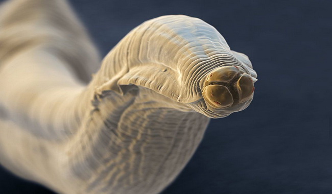 هرآنچه که باید راجع به میوکاردیت بدانیم