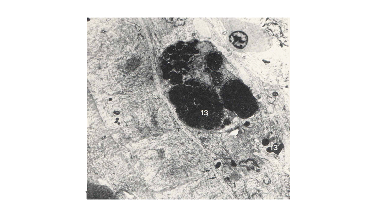 مطالعۀ میکروسکپی و الکترون میکروسکپی اثر نانوذرات آهن در ماهی پلاتی پوسیلوس ماکولاتوس