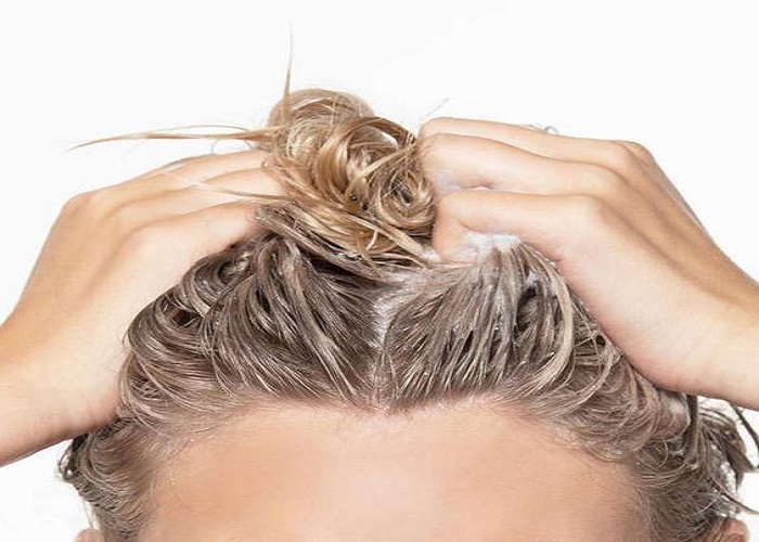 از علت تا درمان خشکی پوست سر