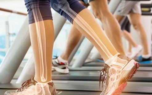 با این اسموتی سلامت و استحکام استخوان ها را تضمین کنید