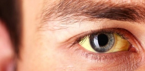 هرآنچه که باید راجع به بیماری تالاسمی بدانیم