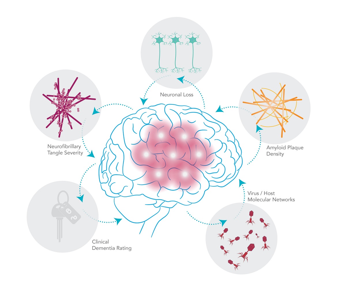 همه چیز درباره ی بیماری آلزایمر همه چیز درباره ی بیماری آلزایمر