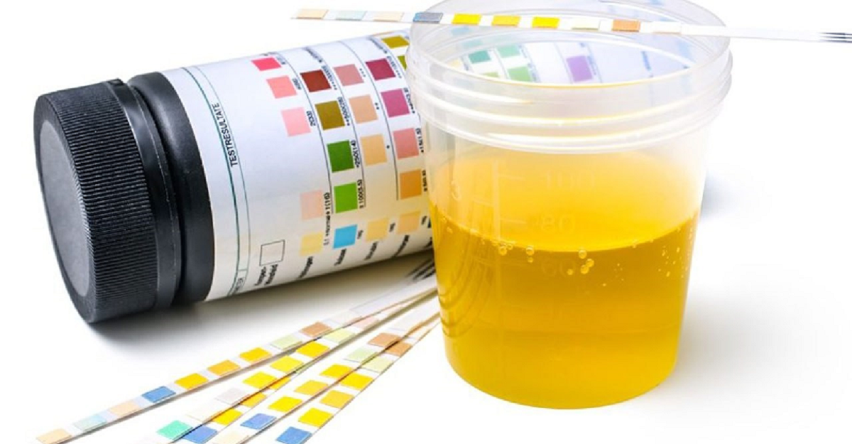 همه چیز درباره تغییر رنگ طبیعی ادرار و ارتباط آن با سلامتی