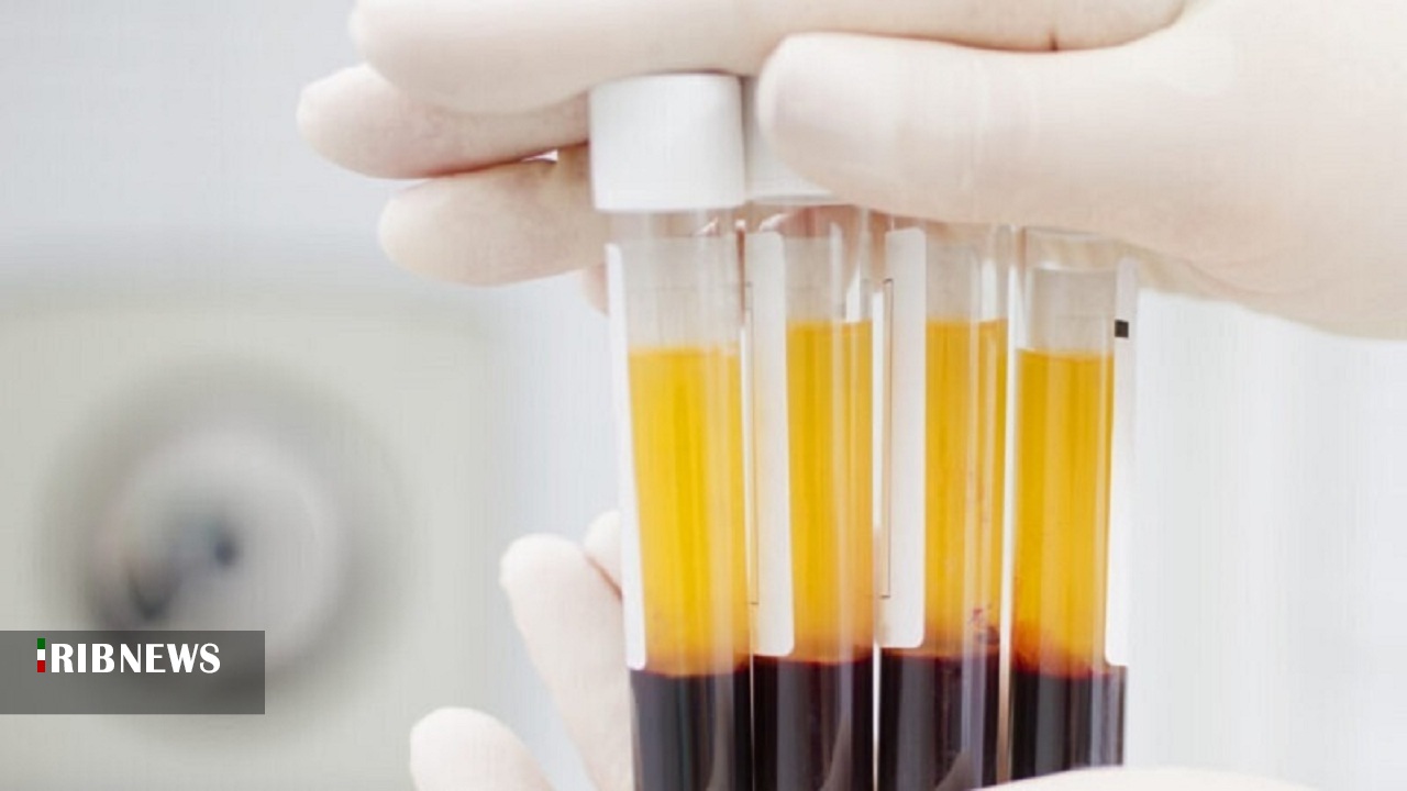 آخرین اخبار مربوط به Covid19 در ایران و جهان