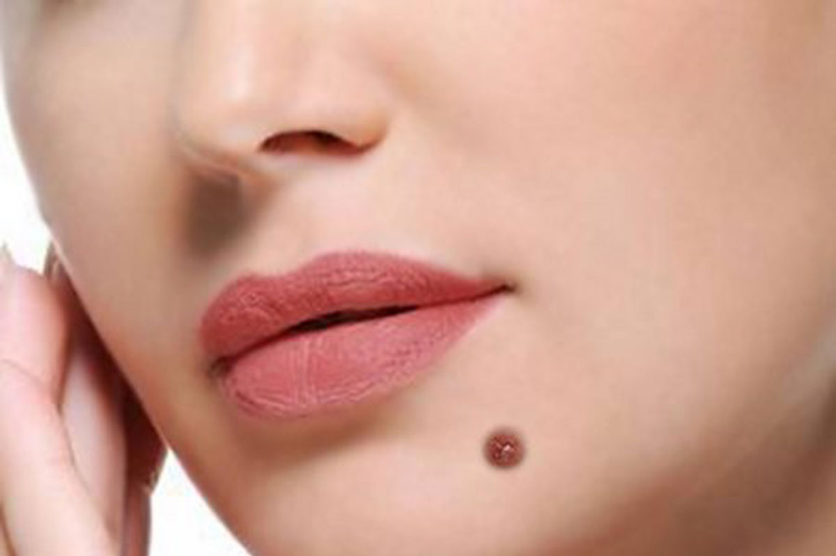 روشهایی برای برداشتن ضایعات پوستی