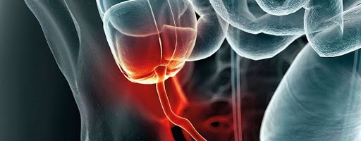 احتمال بروز عارضه آپاندیسیت برای همه