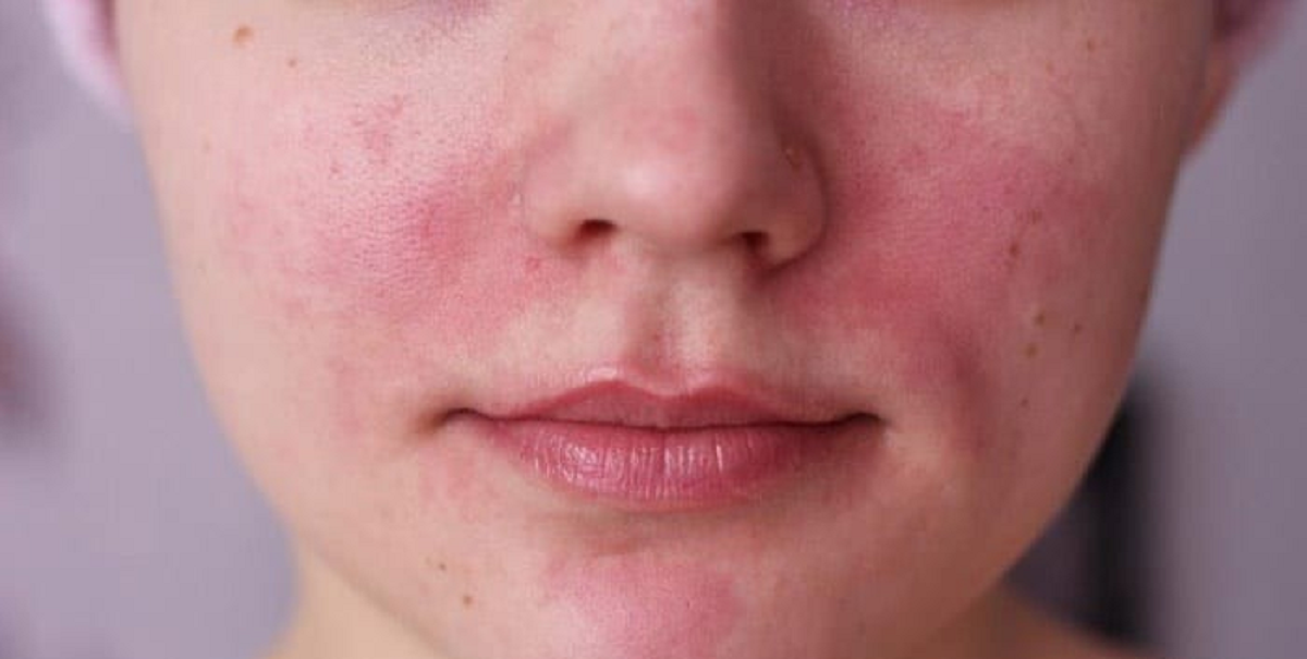 تمام چیزهایی که باید در مورد ضایعات پوستی و علائم و نشانه های آن بدانیم