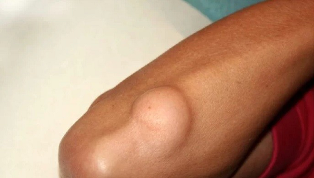 تمام چیزهایی که باید در مورد ضایعات پوستی و علائم و نشانه های آن بدانیم