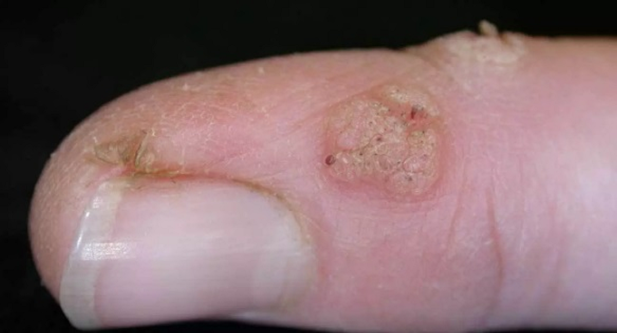 تمام چیزهایی که باید در مورد ضایعات پوستی و علائم و نشانه های آن بدانیم