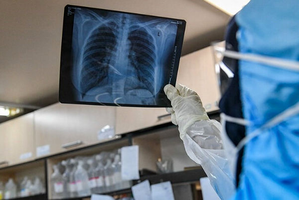 آخرین اخبار مربوط به Covid19 در ایران و جهان