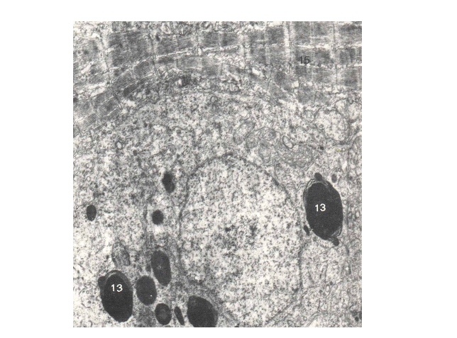 مطالعۀ میکروسکپی و الکترون میکروسکپی اثر نانوذرات آهن در ماهی پلاتی پوسیلوس ماکولاتوس