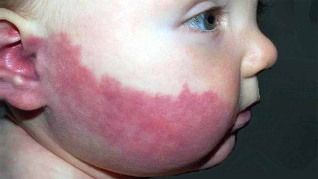 دانستنی هایی در خصوص ماه گرفتگی