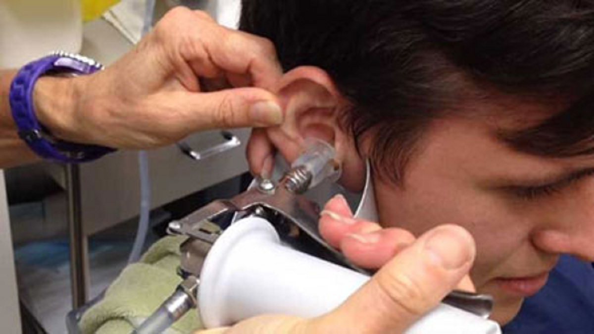 روش خارج کردن جرم یا واکس از درون گوش بدون آسیب رساندن