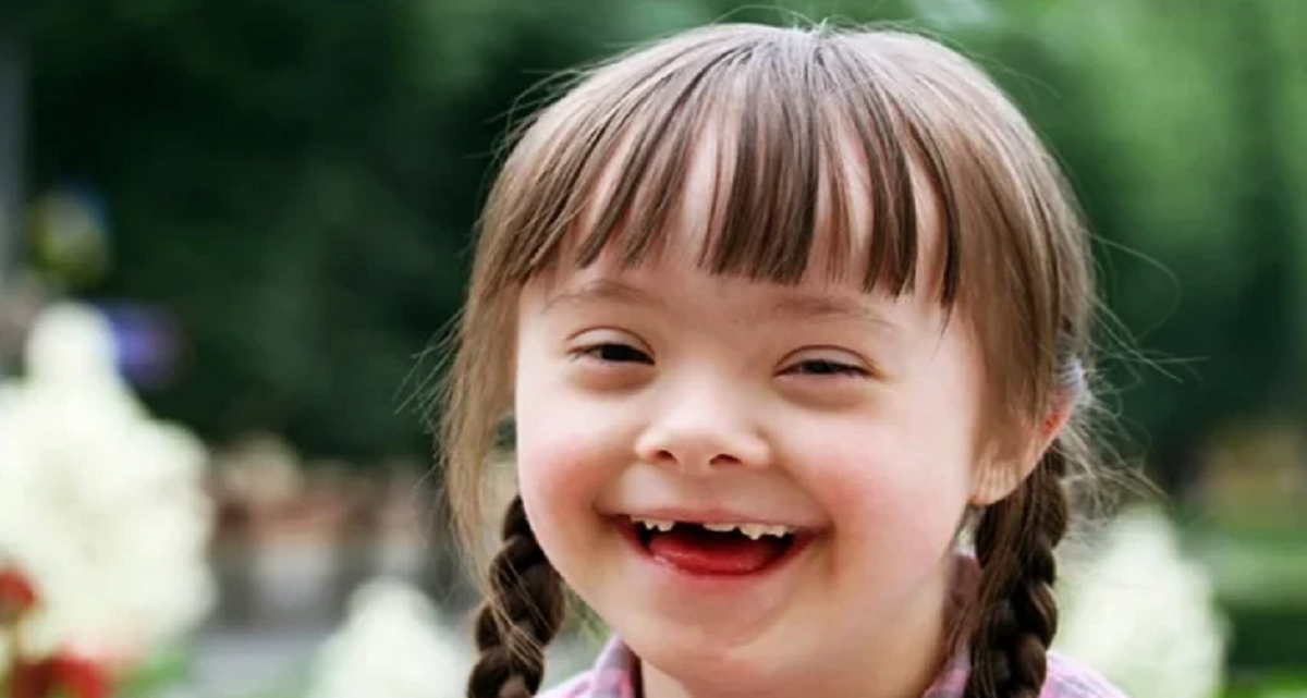 هر آنچه درباره سندروم داون ، علائم،علت‌ ها، راه‌ تشخیص و درمان آن باید بدانیم