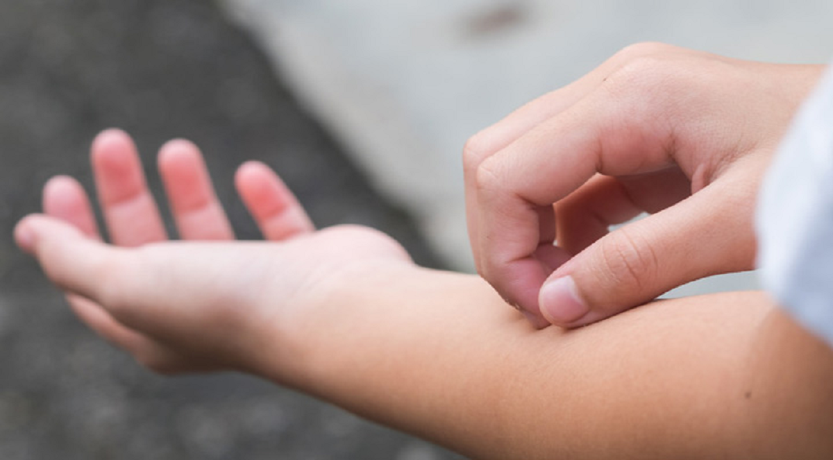 علت خارش پوست و بهترین راه‌های درمان آن