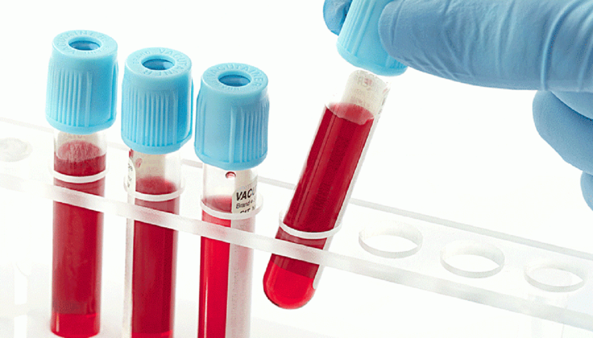 عوامل و علایم حاملگی خارج از رحم و روش های درمانی آن