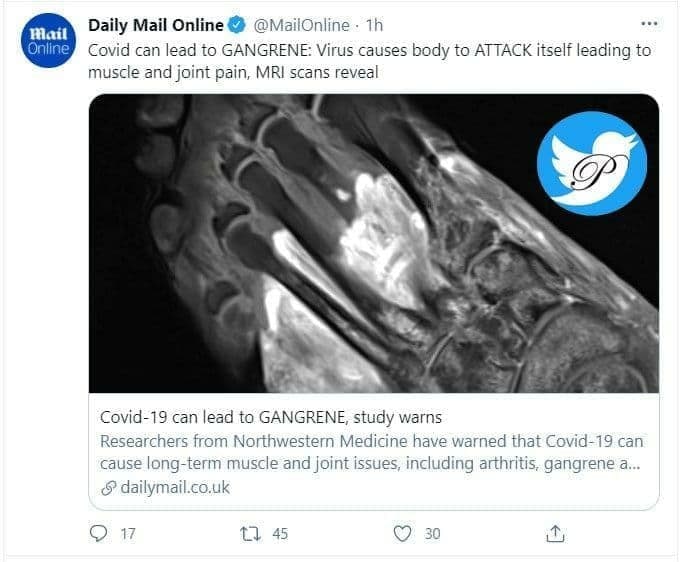 آخرین اخبار از کروناویروس در ایران و جهان