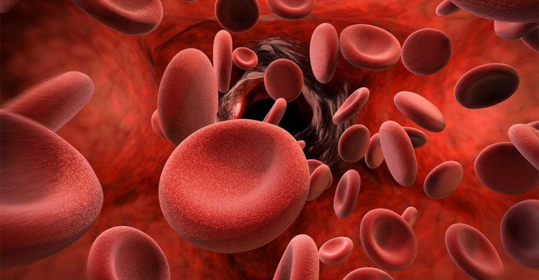 علائم، علل، تشخیص و درمان تلاسمی