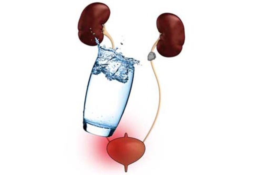 راه درمان بی اختیاری ادرار