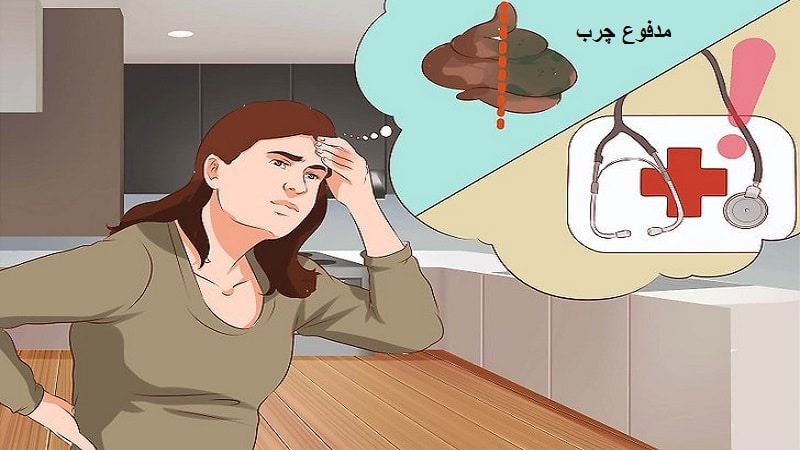 از علت تا درمان اسهال چرب