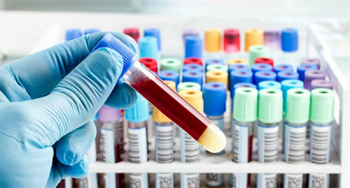 سرطان روده چه علائمی دارد و مراحل تشخیص و درمان آن چگونه است