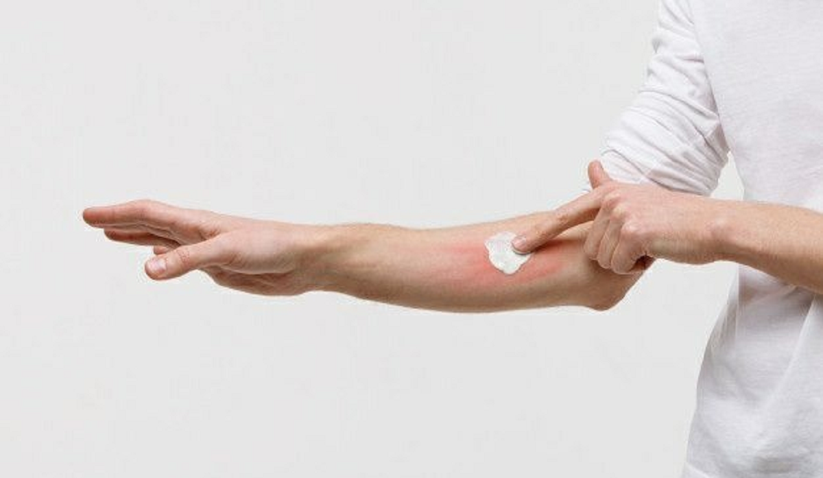 همه چیز راجع به بیماری گال و راه های درمان آن