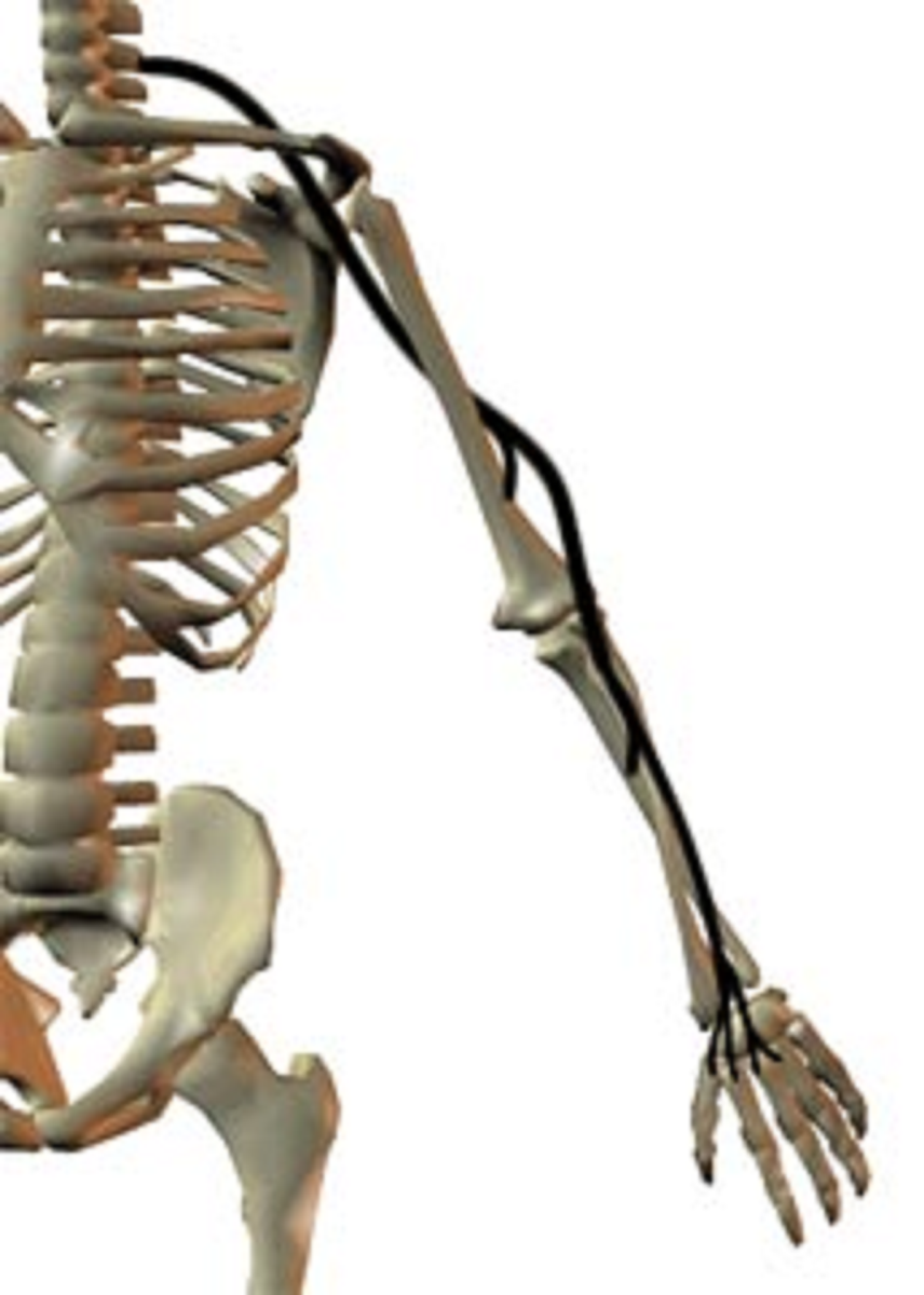 علائم و درمان آسیب های عصب رادیال یا افتادگی مچ دست