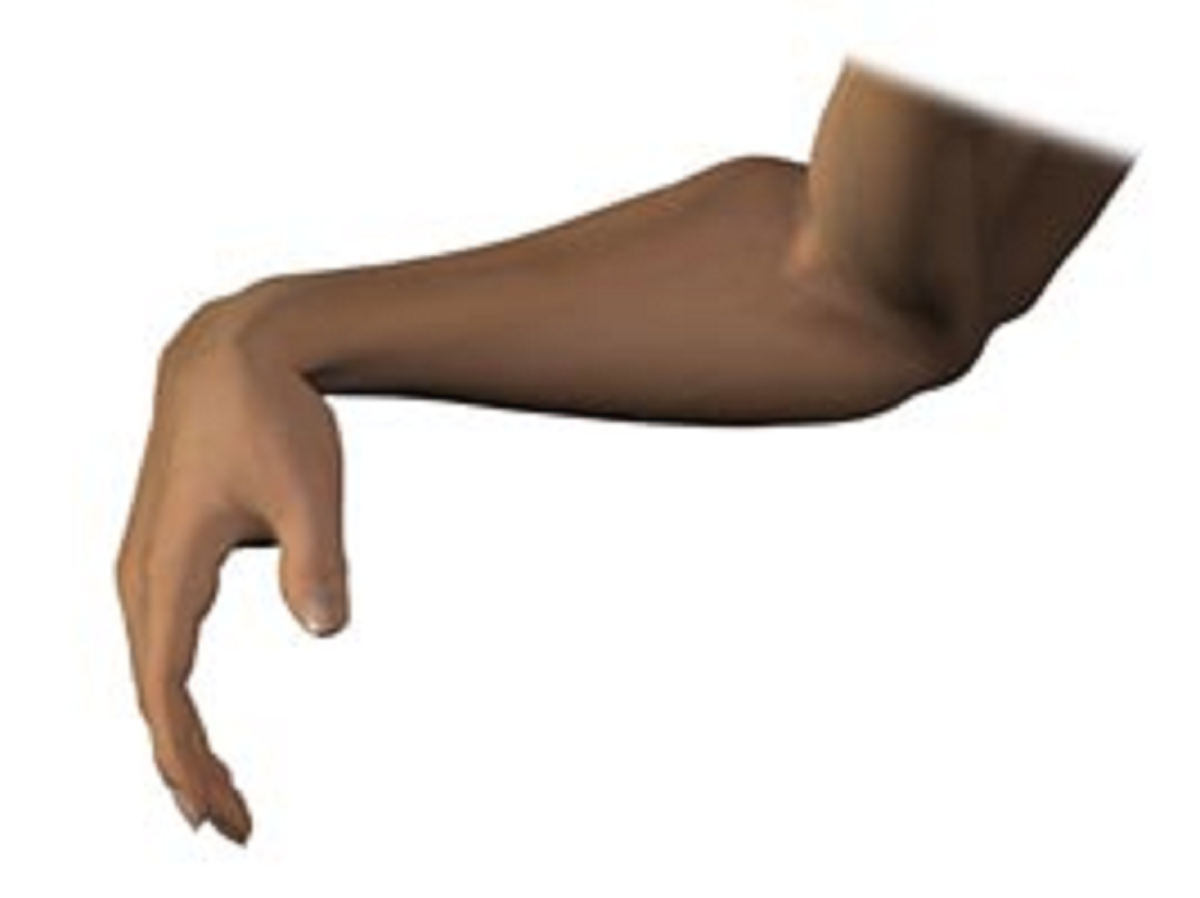 علائم و درمان آسیب های عصب رادیال یا افتادگی مچ دست