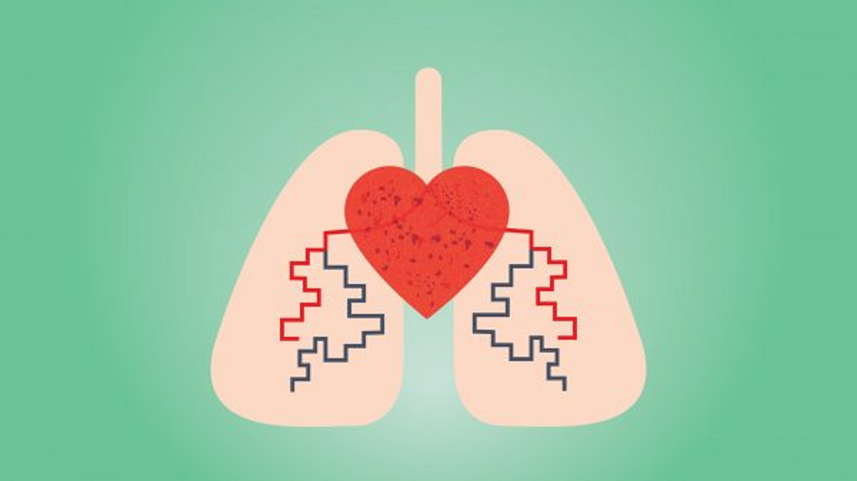 خطرات فشار خون ریوی بالا و علائم و روشهای درمان آن