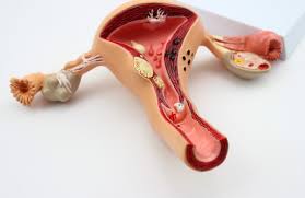 افتادگی مثانه چیست؟