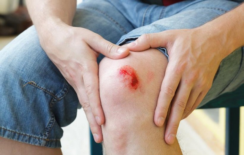 عفونت زخم، علائم و راهکارهای درمانی آن