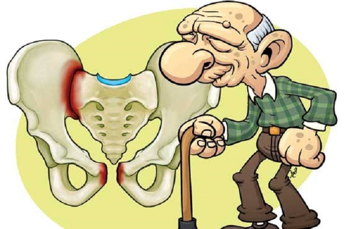 شکستگی لگن چیست و چگونه درمان میشود؟