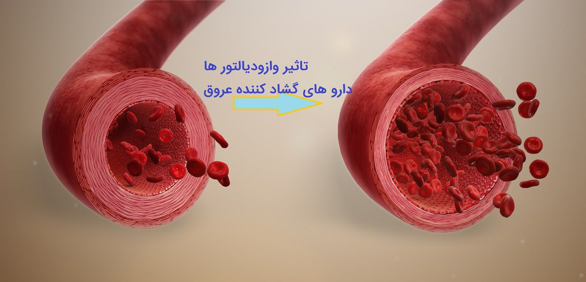 خطرات فشار خون ریوی بالا و علائم و روشهای درمان آن