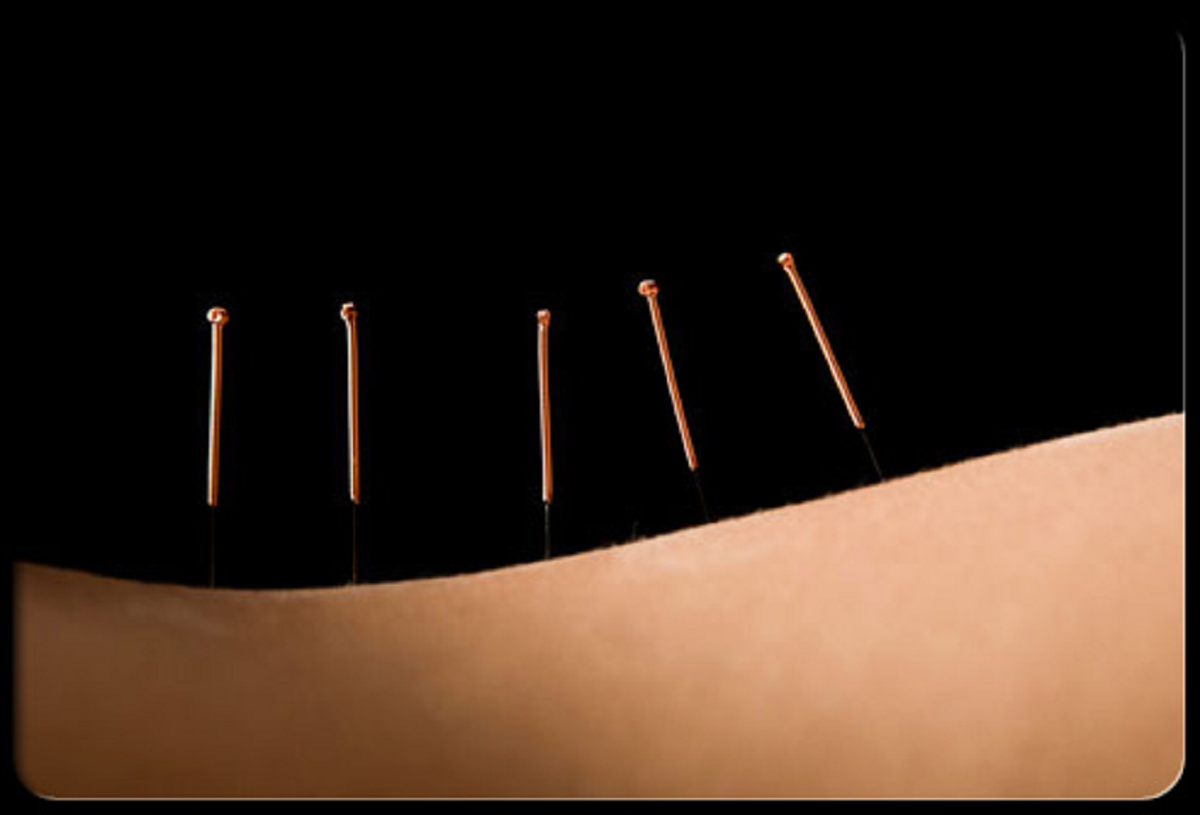 علت درد سیاتیک، علایم ، راه های تشخیص و درمان آن