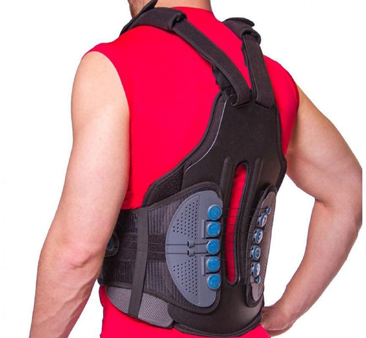 کیفوز یا گوژپشتی چیست و چگونه می توان آن را درمان کرد