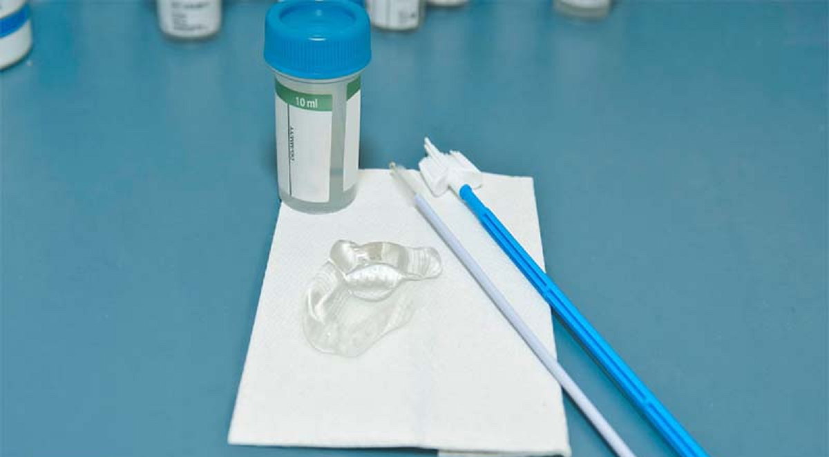 ضرورت انجام تست پاپ اسمیر و نحوه انجام آن